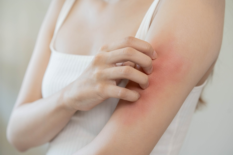 woman scratching red rash on arm